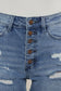 button fly shorts